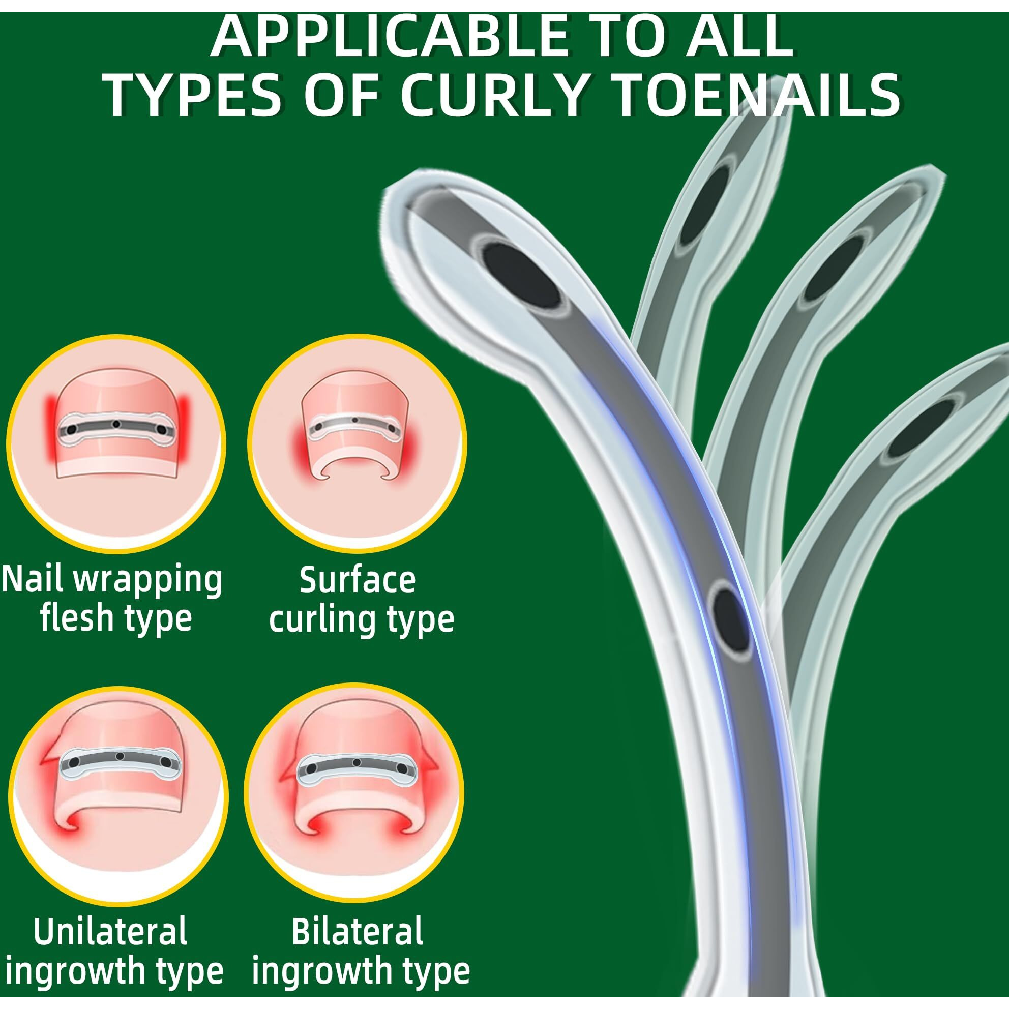 Titanium Alloy Ingrown Toenail Treatment & Removal Kit For Quick Relief  Ingrown Toenail Removal Kit  Professional Ingrown Toenail Corrector  Ingrown Toenail Tools For Quick Relief  10 Pcs