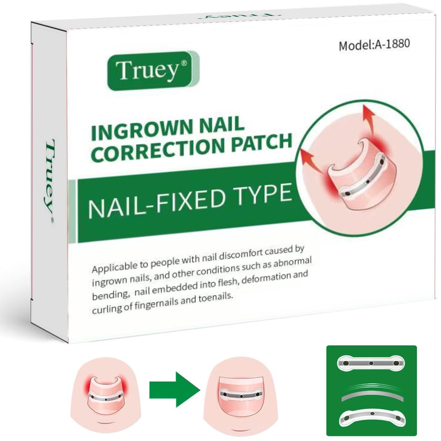 Truey Titanium Alloy Silicone Ingrown Toenail Treatment  Nail Correction Patch  Ingrown Toenail Corrector  Nail Correction Tool  Ingrown Toenail Removal Kit  Applicable For Any Toenail Size Men Woman