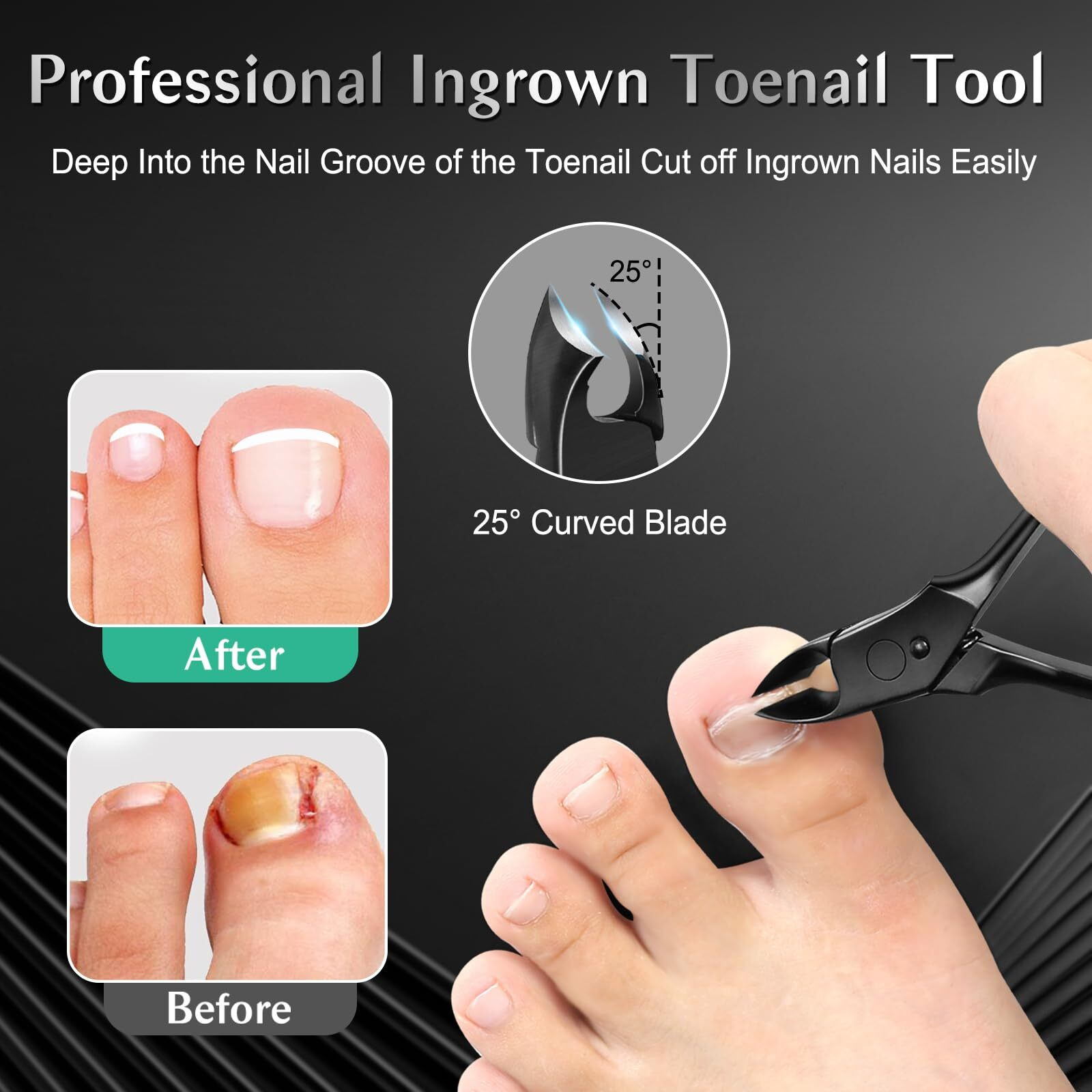 Leyoufu Toenail Clippers For Seniors Thick Nails  Professional Ingrown Toe Nail Clippers Tools  Wide Jaw Opening Finger Nail Cutter 5-In-1 Heavy Duty Nail Clipper Kit Gifts For Men & Women Adult