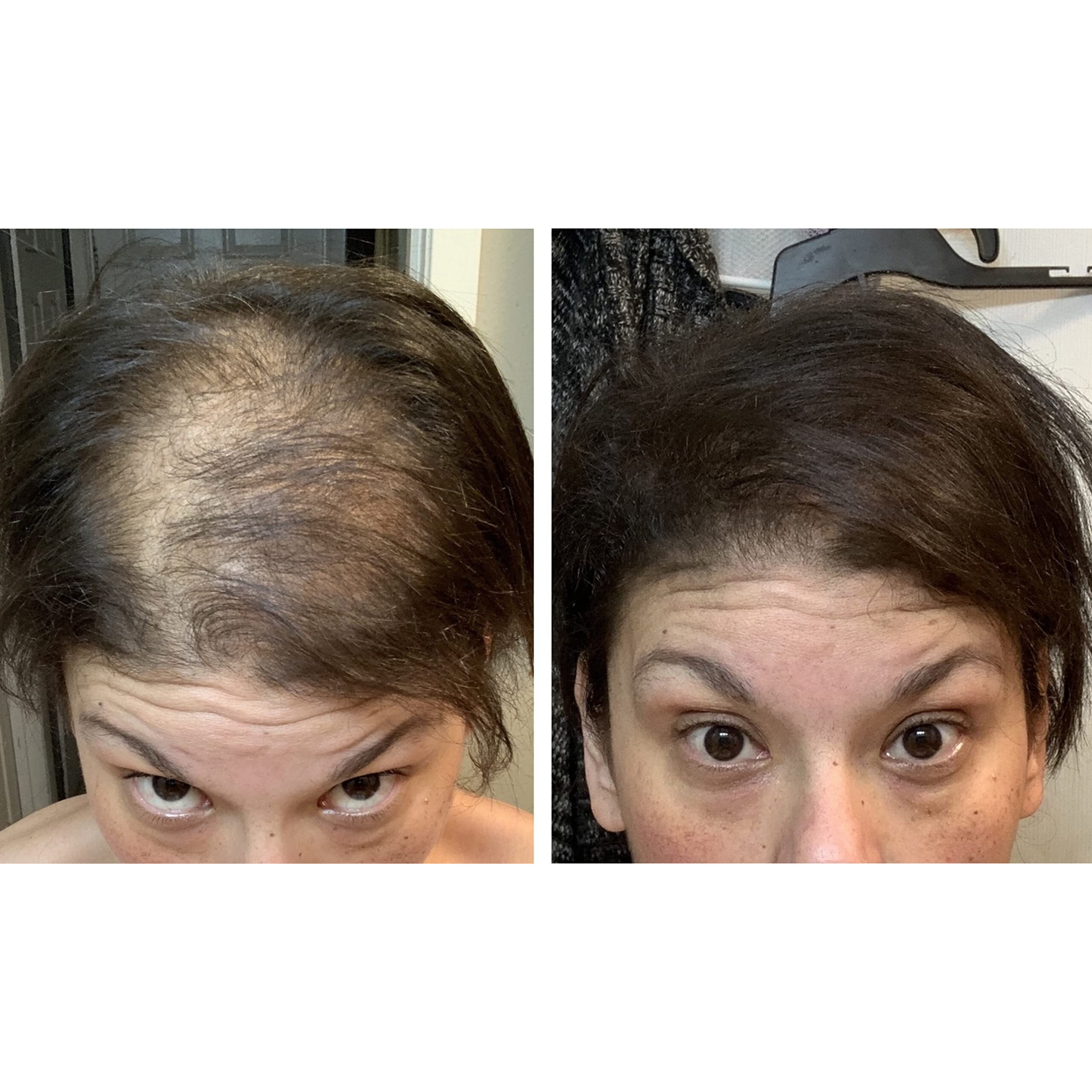 Caboki Hair Building Fiber 16G (Dark Brown)