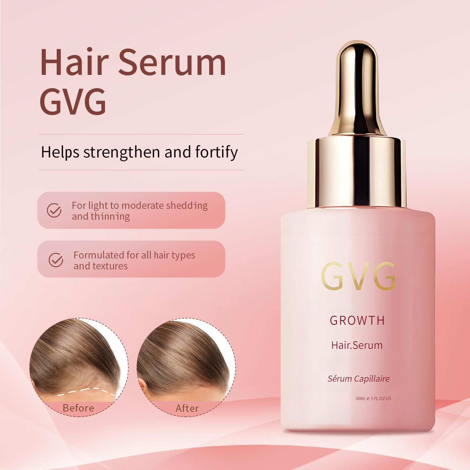Hair Growth Serum Hair Loss Treatment For Women And Men - Gro Hair Serum For Thining Hair - Fuller Thicker And Healthier Hair  1 Fl Oz