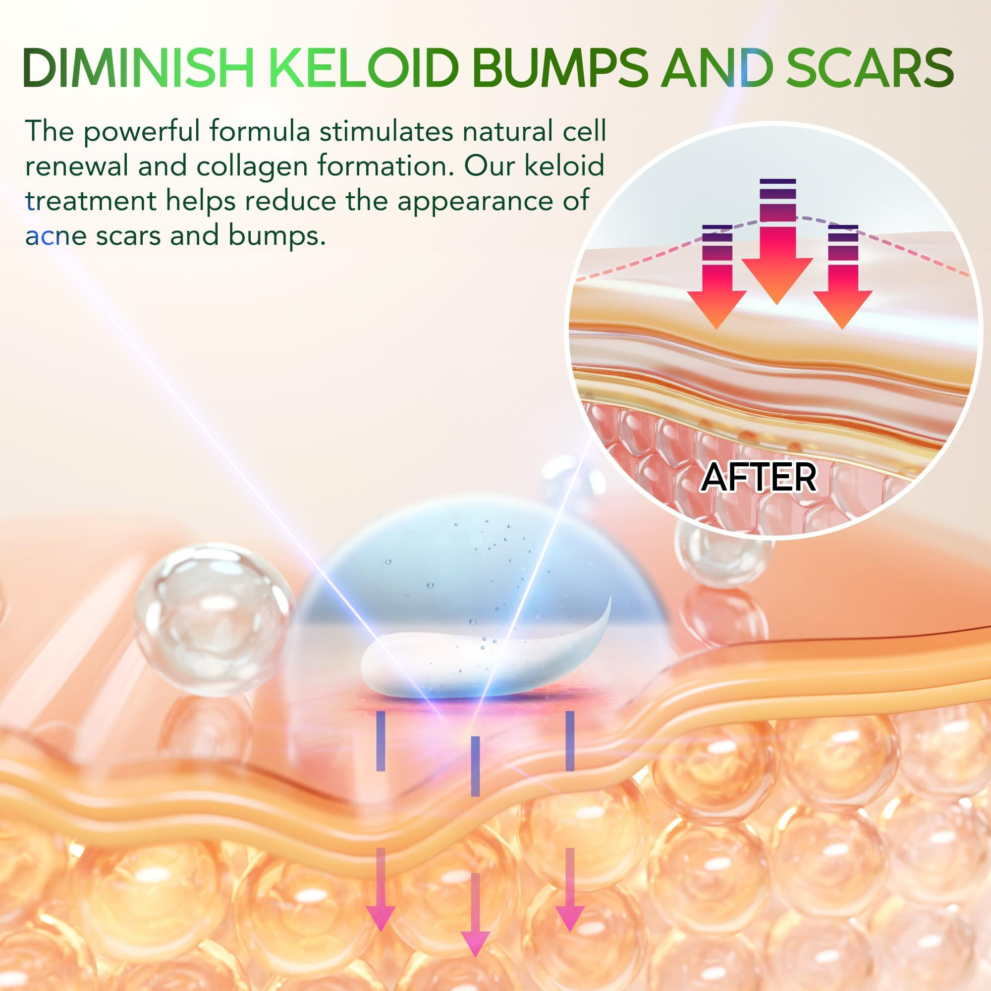 Advanced Keloid Bump Removal Gel Silicone Keloid Scar Removal Cream For Scars From Piercing  Surgical Marks  Acne  And Burns  Keloid Treatment For Ears  Face  And Body With Healing Formula 30G