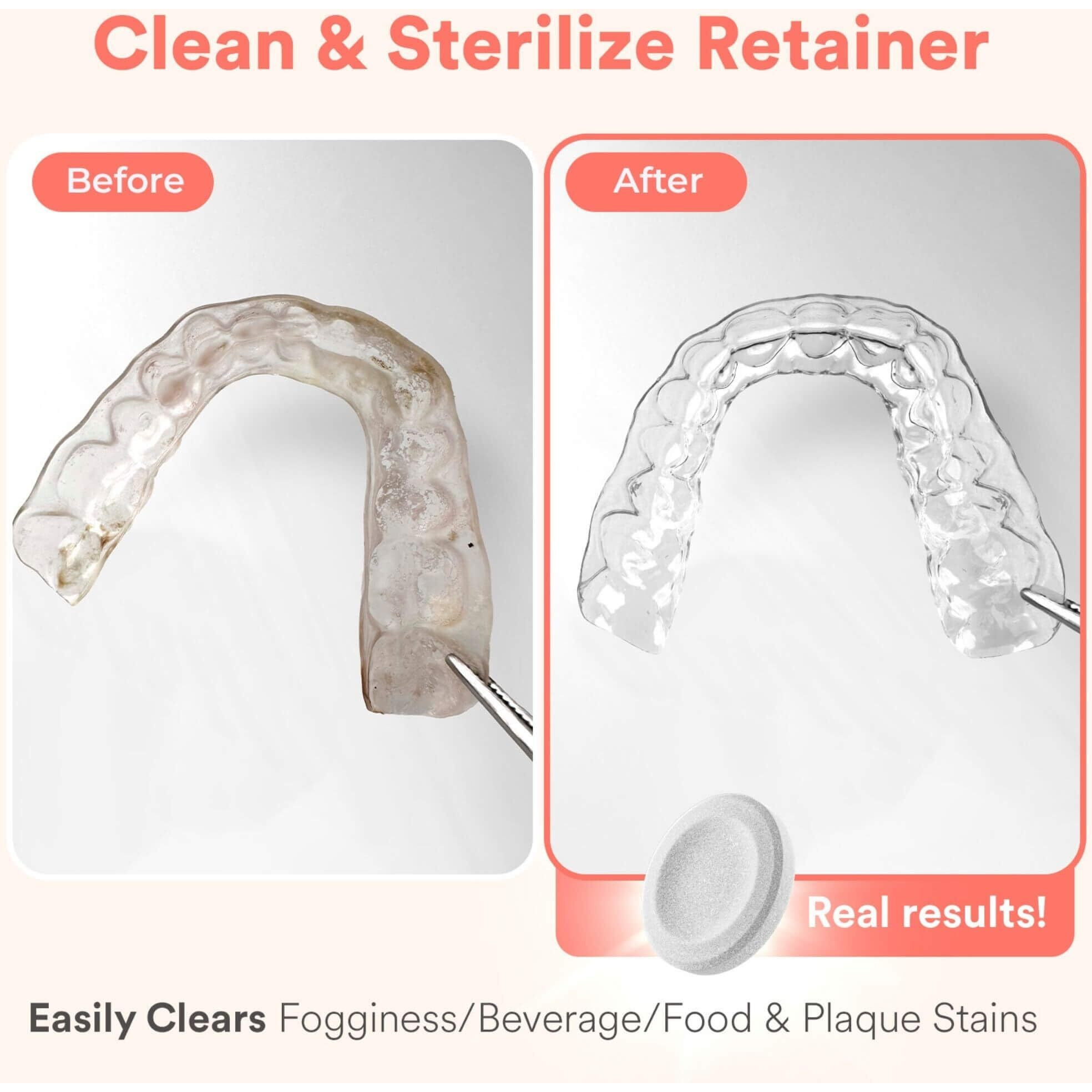 Weiss Naturals Retainer Cleaning Tablets  Invisalign Cleaner  Remove Stains  Odors & Plaque  Fsa & Hsa Eligible  Night Guard Cleaner Persulfate & Dye-Free 1-Month Supply  Denture Cleaners  30 Tablets