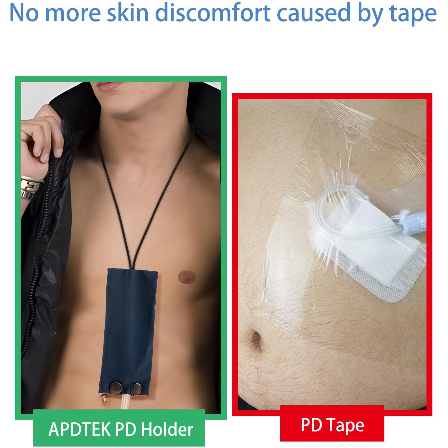 Peritoneal Dialysis Catheter Holder For Baxter 5C4482 5C4483  Pd Catheter Lanyard Pd Secure Shower Support Pd Transfer Set Catheter Holder Accessories For Men & Women (Dark Blue)