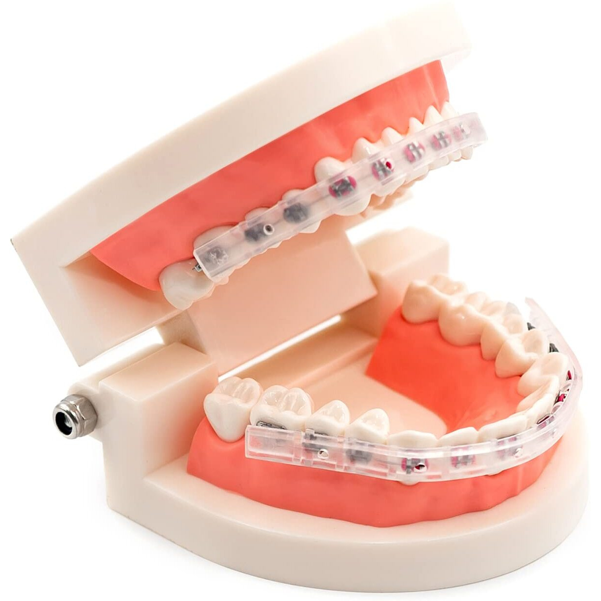 Aim Lip Protector For Braces  Comfort Covers For Braces  Orthodontic Mouth Guard For Braces  Wax Braces Cover  Lip Bumper  Lip Shield For Brackets  Braces Accessories (Lip Protector)