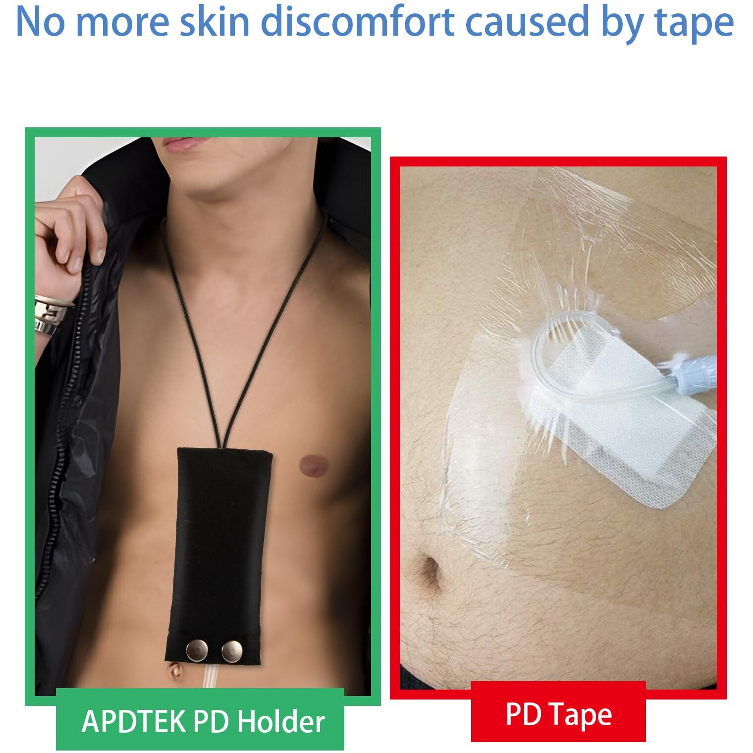 2Pcs Peritoneal Dialysis Catheter Holder For Baxter 5C4482 5C4483  Pd Catheter Lanyard Pd Secure Shower Support Pd Transfer Set Catheter Holder Accessories For Men & Women (Black)