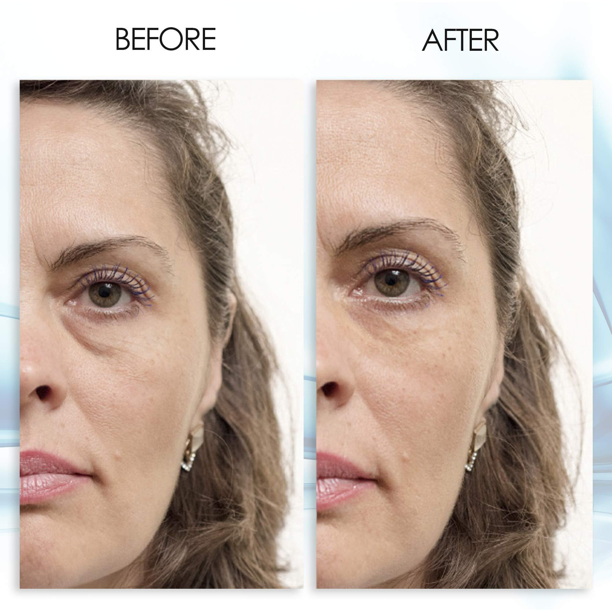 Puffy Eye Gel Instant Results - Naturally Rapid Reduction Eye Gel  Eliminate Wrinkles  Puffiness And Bags - Hydrating Eye Gel W/Green Tea Extract By Aqua Mineral - 1 Oz