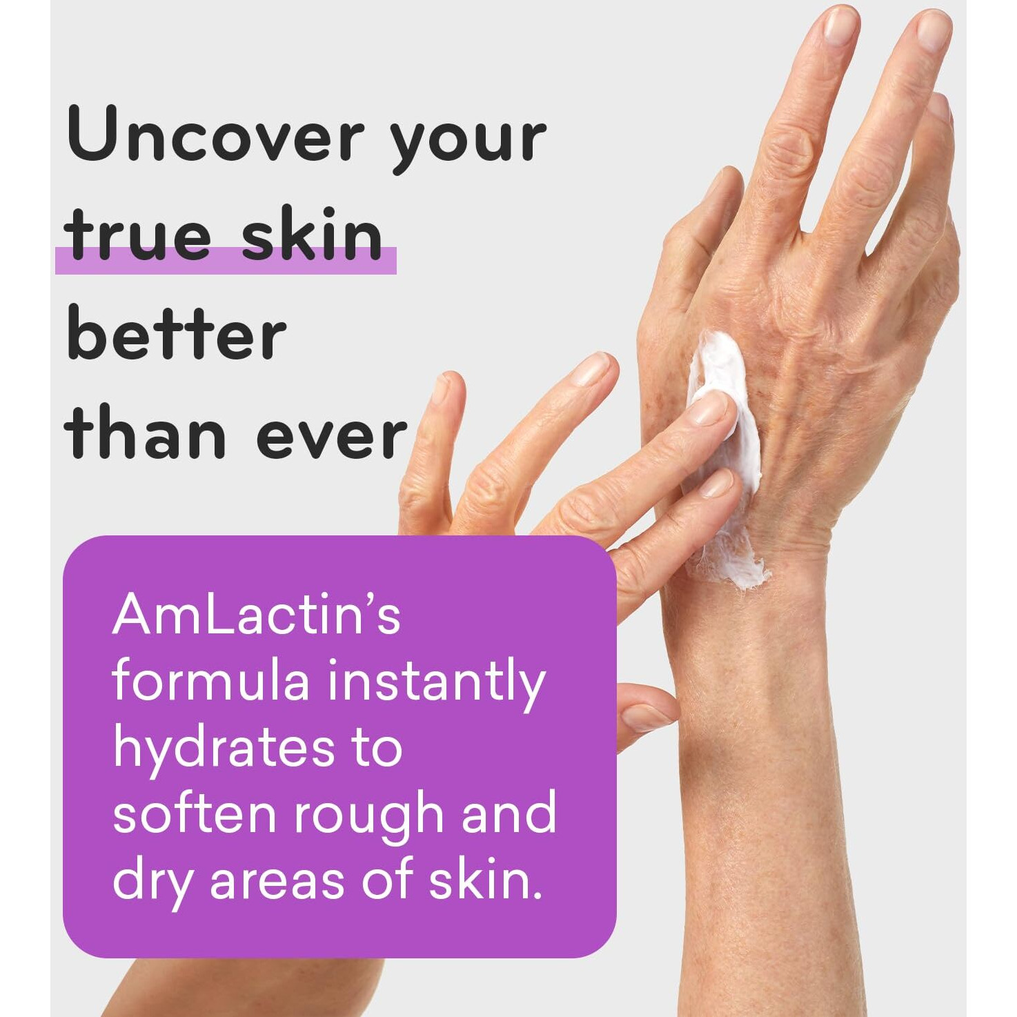 Amlactin Ultra Smoothing - 4.9 Oz Body & Hand Cream With 15% Lactic Acid - Exfoliator And Moisturizer For Rough And Bumpy Dry Skin (Packaging May Vary)