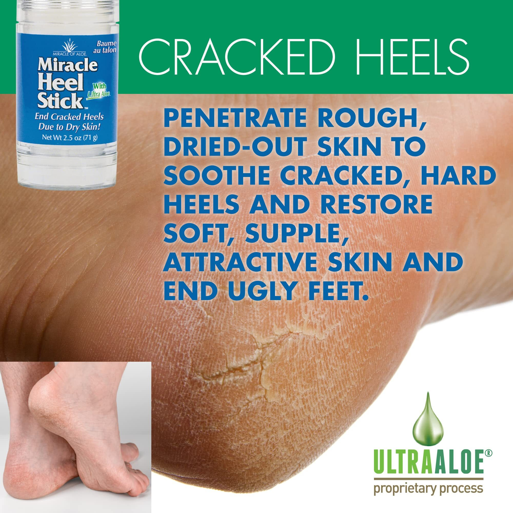 Miracle Heel Stick 2.5 Oz Stick And Miracle Foot Repair 1 Oz. Tube | Made With Pure Ultraaloe Gel | Keeps Feet And Heels Looking And Feeling Their Very Best