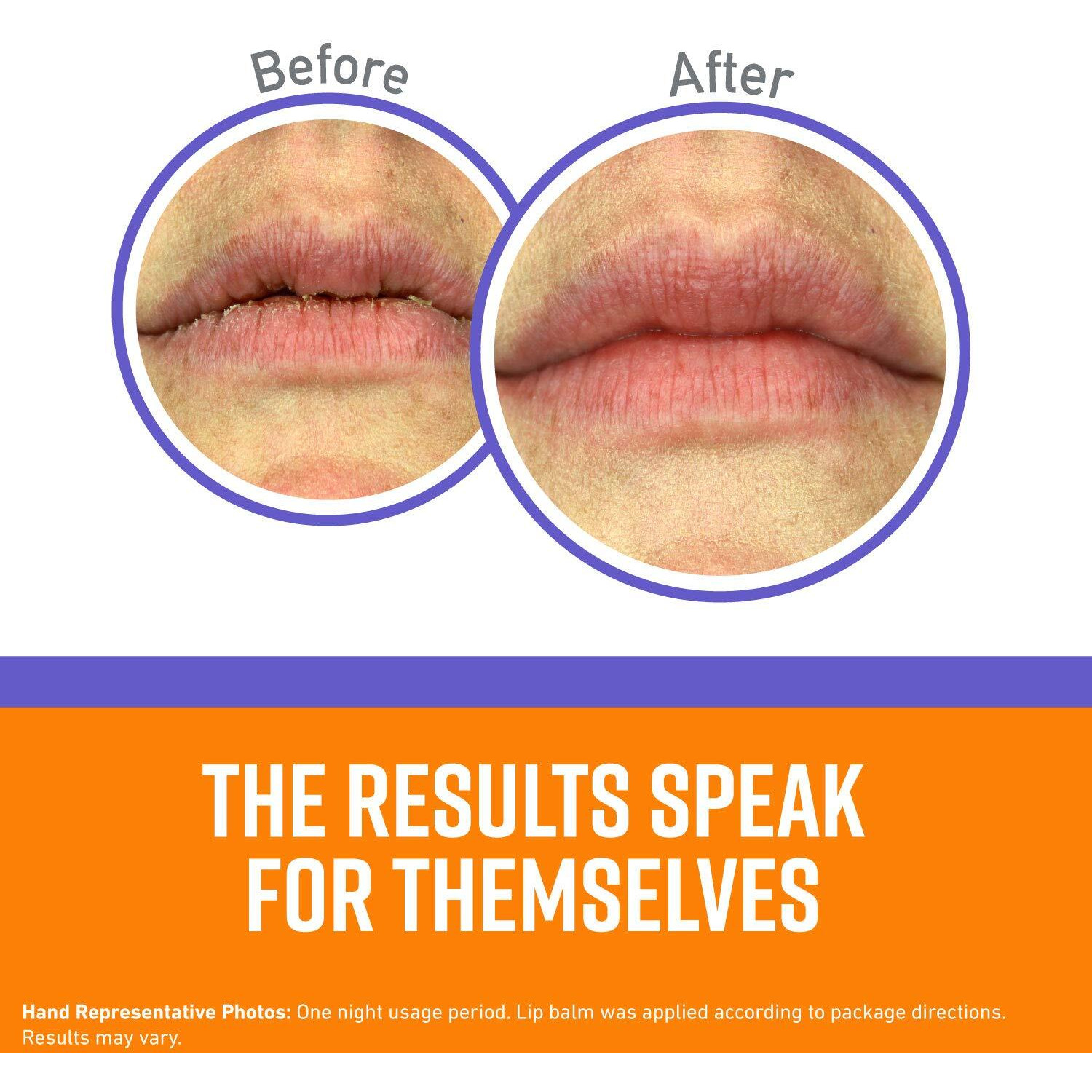 O'Keeffe's Lip Repair Night Treatment Lip Balm, .25 Ounce Jar, (Pack Of 2)