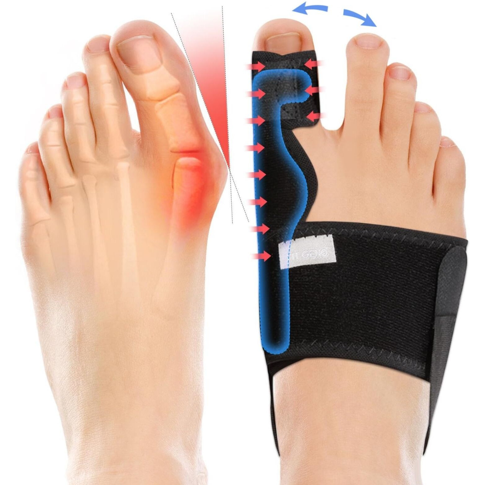 Fitgeno Bunion Corrector Women & Men Big Toe Foot Straightener Splint Brace - Adjustable Bunyan Correction Orthopedic For Hallux Valgus Pain Relief 2 Pcs