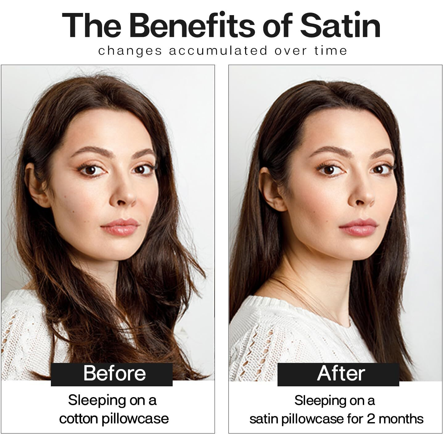 Mr&Hm Satin Pillowcase For Hair And Skin, Silk Satin Pillowcase 2 Pack, Queen Size Pillow Cases Set Of 2, Silky Pillow Cover With Envelope Closure (20X30, Light Pink)