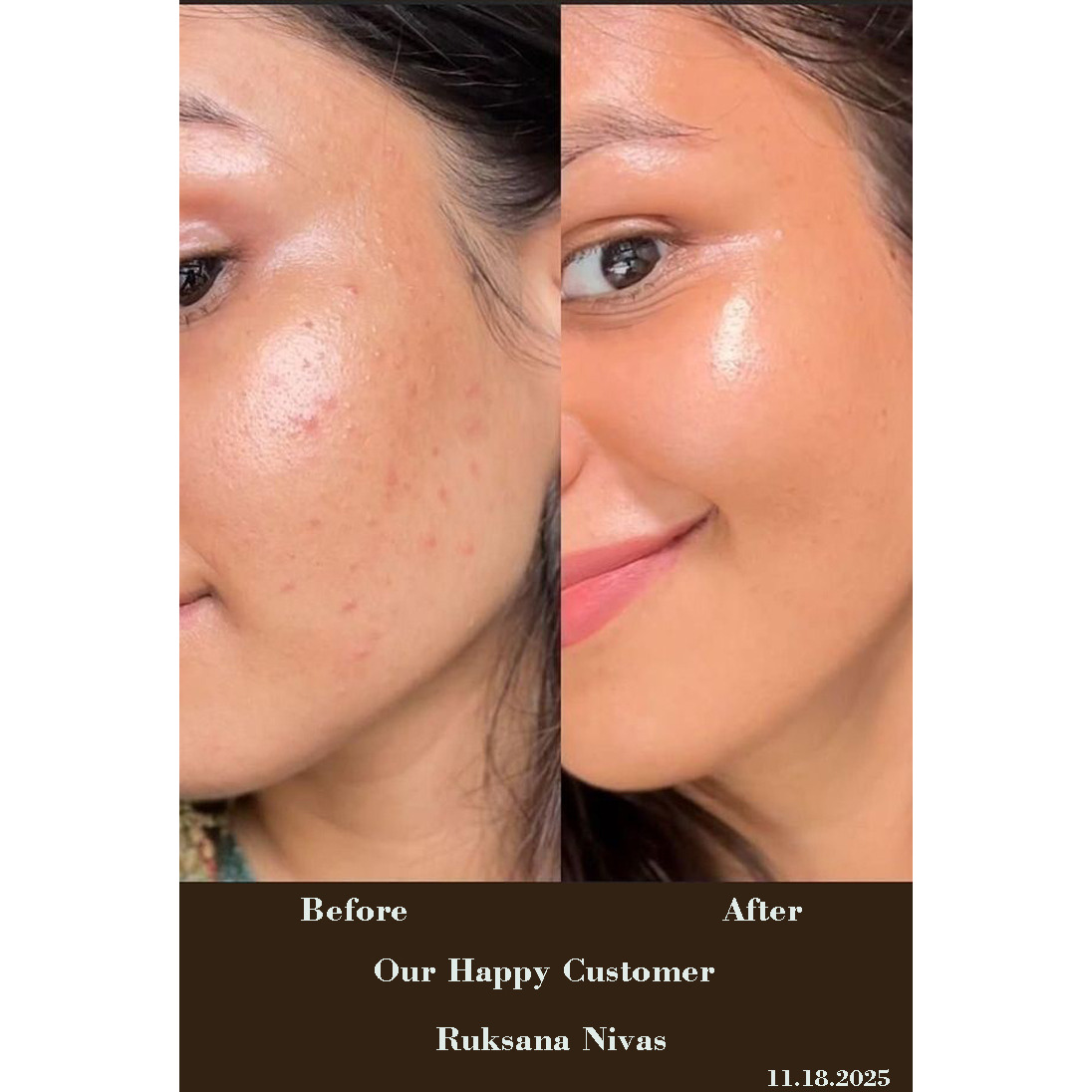 12% Vit C & 2% Alpha Arbutin Serum