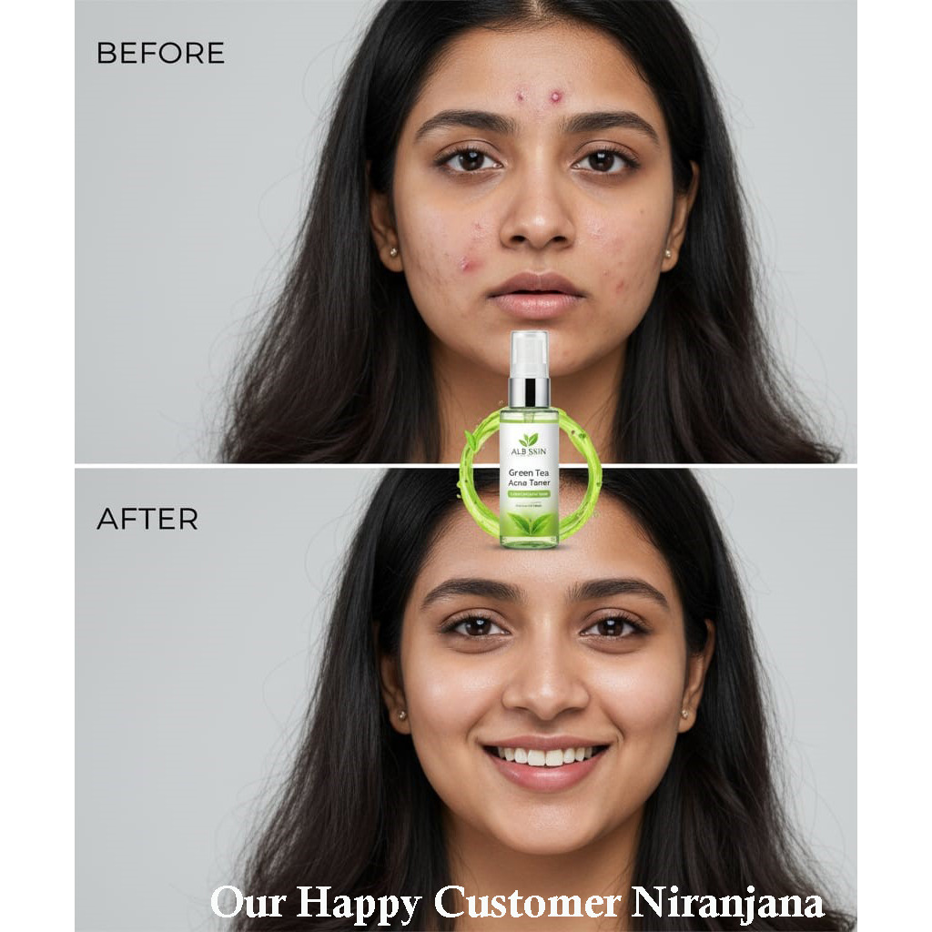 Green Tea Acne Toner