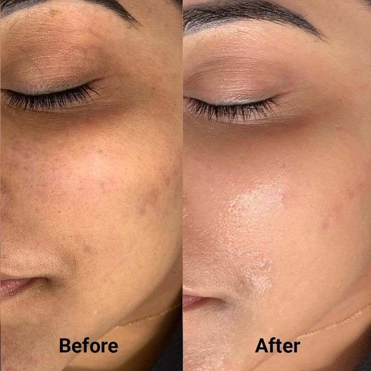 Dry & Sensitive Skin Cleanser